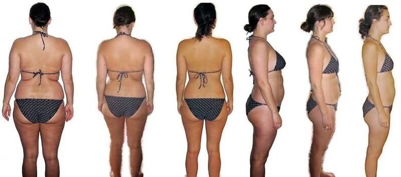 Antes e depois de perder peso
