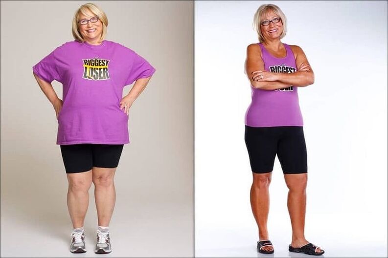 Mulher antes e depois de perder peso